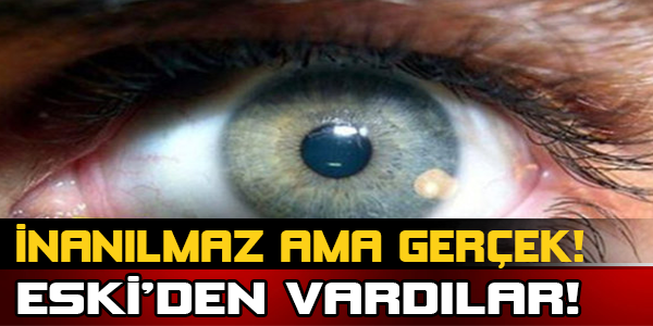 İnanılmaz Ama Gerçek! Eski'den Vardılar!