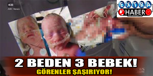 2 beden 3 bebek!